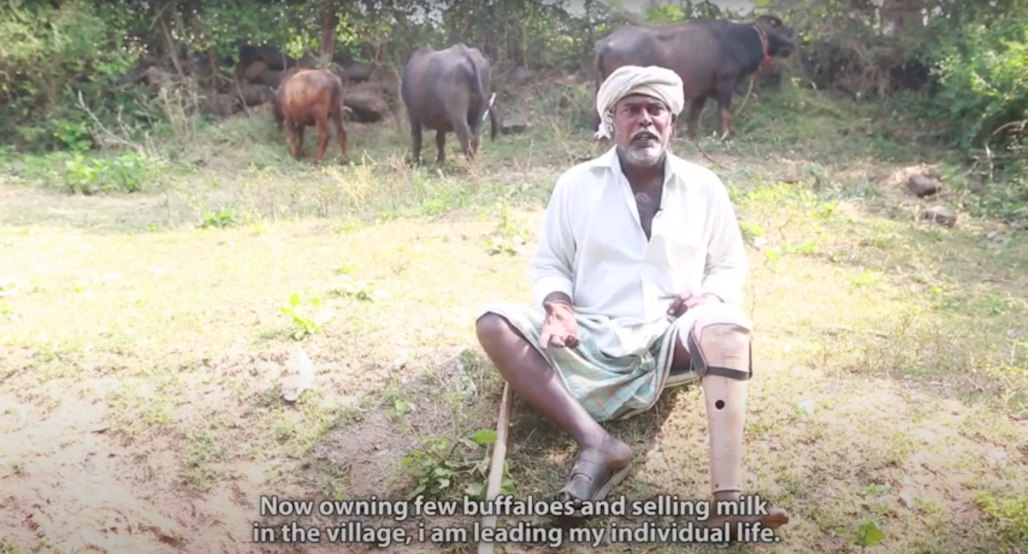 Chetana Foundation – Artificial Limb Donation in collaboration with Rotary Club, Khammam, India